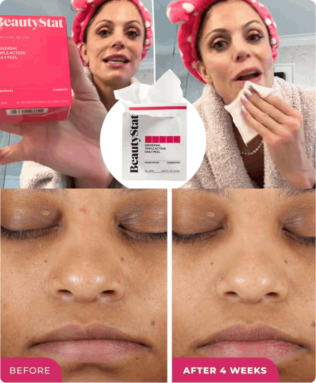 How to use Beautystat